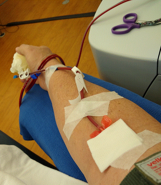 20200424 Triple Platelets.gif